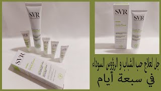 جل للقضاء على البثور وحب الشباب والرؤوس السوداء من SVR active gel sebiaclear [upl. by Aynotan]