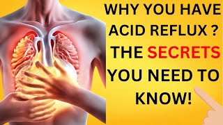 The Hidden Causes of Acid Reflux You Need to Know [upl. by Yrrok]