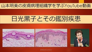 日光黒子とその病理組織学的鑑別疾患 dermatopathology 山本明美 lentigo [upl. by Milson681]