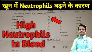 High Neutrophil Count in blood test  high neutrophils in blood  neutrophil count  neutrophils [upl. by Riancho]