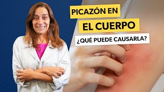 6 causas de COMEZÓN y cómo tratar  con la Dra Aline Bressan Dermatólogo [upl. by Redan]