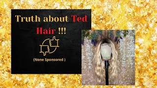 Ted Hair Review  Reaction to Ted Hair  Truth about Ted Hair [upl. by Aeht189]