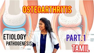 osteoarthritis  causespathophysiology clinical features part 1 in tamil [upl. by Erund]