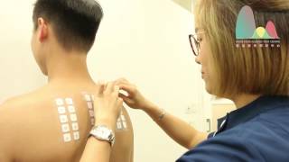 skin patch test hong kong allergen patch test  MedDx Allergy hong kong [upl. by Auqemahs]