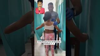 Scoliosis treatment shortsyt short shortfeedtrend [upl. by Revell]