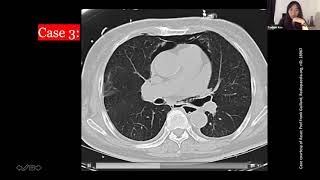 Approach to CT scan of the Acute Abdomen [upl. by Ogires244]