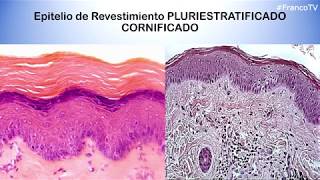 Histología  Epitelios de Revestimiento [upl. by Leahcimaj]