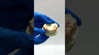 🌟 Lets talk Partial Dentures bossiercitydentist teethinaday partialdenture dentistry [upl. by Ultima996]