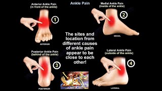 Ankle Pain  Everything You Need To Know  Dr Nabil Ebraheim [upl. by Leiso]