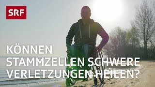 Stammzellen Ein Wundermittel der Medizin  Erklärvideo  SRF [upl. by Rosenblatt]