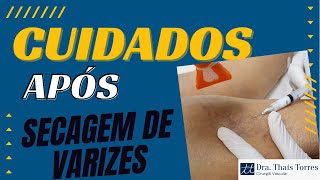 Cuidados após secagem de varizes  escleroterapia ou aplicação [upl. by Placida]