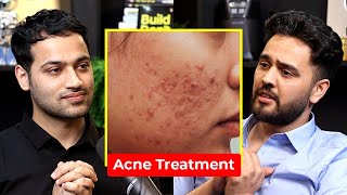 Pimple amp Acne Treatment  DO THIS  Dermatologist  Dr Gurjot Marwah  Raj Shamani Clips [upl. by Nedla]