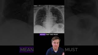 Hilum overlay sign  chest xray interpretation radiology medicalstudent radiologist [upl. by Naimaj]