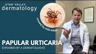 Papular Urticaria Explained by an Expert Dermatologist  Utah Valley Dermatology [upl. by Yraeg]