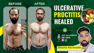 Anand gets rid of Ulcerative Proctitis  Med free [upl. by Nico]