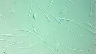 Growing fibroblasts [upl. by Nalyt]