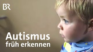 AutismusDiagnose Mit Hirnscans Autismus früher erkennen  Gut zu wissen  BR [upl. by Catha]