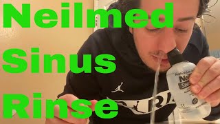 Neilmed Sinus Rinse How to Use [upl. by Pisarik]