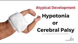 Atypical Development Baby Hypotonia or Cerebral Palsy  How do I tell at 10 Months Old [upl. by Aile883]