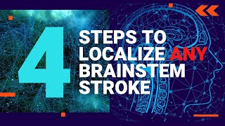 Localize ANY Brainstem Stroke in 4 INSANELY EASY steps [upl. by Manthei]