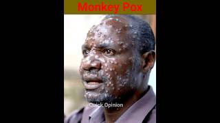 M pox Virus Monkey Pox New Virus shorts facts mpox [upl. by Enail508]