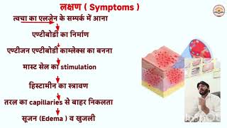 urticaria पित्ती पित्ती लक्षण कारण निदान रोकथाम और उपचार [upl. by Anbul722]