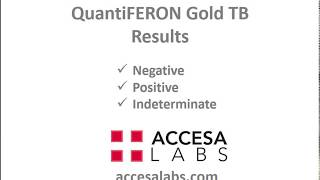 TB Blood Test QuantiFERON Gold TB Blood Test Results Overview [upl. by Lorusso]