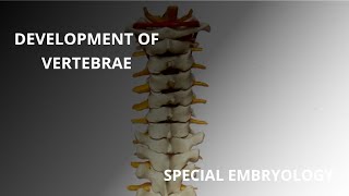 Development of Vertebral Column [upl. by Atikan933]