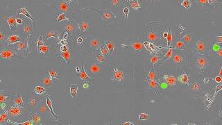 Essen BioScience CellPlayer Kinetic Cytotoxicity Assay [upl. by Aicilf640]