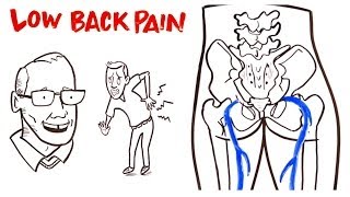 Low Back Pain [upl. by Yntrok]