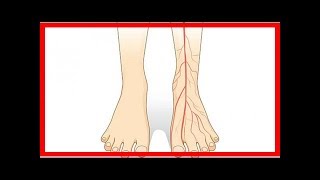 Conseils pratiques pour soulager la mauvaise circulation sanguine dans les jambes [upl. by Aneis]