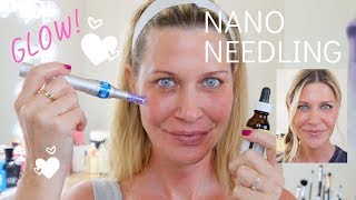 ☀️Nano Needling  How to needle at home for SERIOUS glow [upl. by Lynnell]