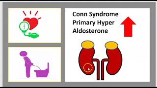 LAlcalose Métabolique Équilibre acidobasique Rénine Angiotensine SRAA Aldosterone Syndrome de Conn [upl. by Meuse]