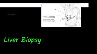 Liver Biopsy Indications Contraindications and Methods [upl. by Ogram582]