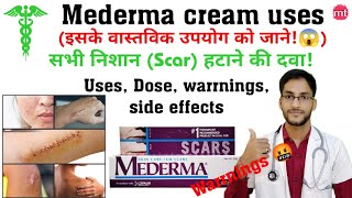 Mederma creammederma cream for acne scarmederma advance plus creammederma cream uses medicinetalk [upl. by Quent44]