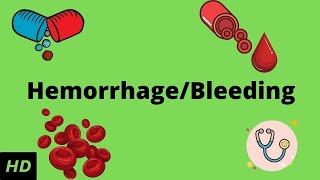 Hemorrhage bleeding Causes Signs and Symptoms Diagnosis and Treatment [upl. by Holmun]