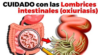 SÍNTOMAS DE LOMBRICES INTESTINALES oxiuriasis tratamiento y cómo prevenirlas [upl. by Gnues]