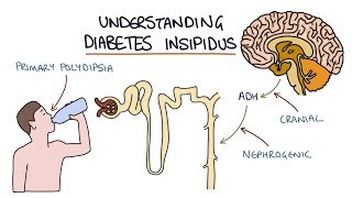 Understanding Diabetes Insipidus [upl. by Wash]