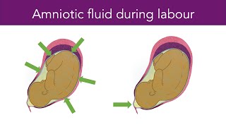 Amniotic Fluid During Labour [upl. by Enomis]