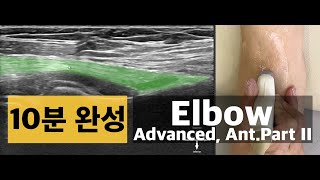 Elbow Advanced 1 Anterior part II  biceps tendon elbow joint  KAOM 강사 한범기 [upl. by Atsirt]