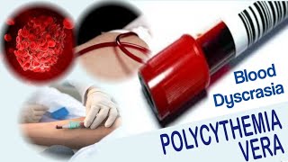 Polycythemia Vera  Blood Dyscrasia  Causes Symptoms Diagnosis and Treatment [upl. by Animar]