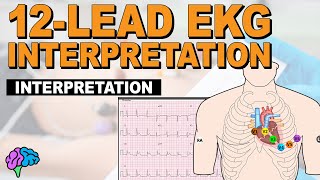 The SIMPLE Steps of 12Lead EKG Interpretation  EXPLAINED CLEARLY [upl. by Judson]