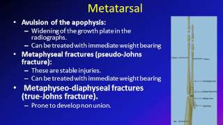 Metatarsal Fractures  Everything You Need To Know  Dr Nabil Ebraheim [upl. by Pauline278]