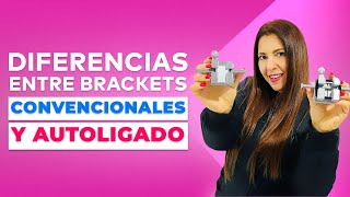 Diferencias entre Brackets Convencionales y Autoligado [upl. by Columbyne]