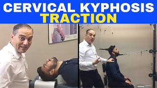 Cervical Kyphosis Traction Corrective Chiropractic Care  Dr Walter Salubro [upl. by Lovato]