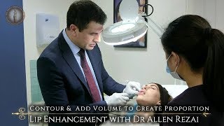 Natural Look Lip Filler Treatment with Dr Allen Rezai [upl. by Ykcor]