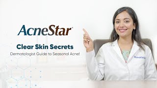 How to treat seasonal acne  AcneStar Gel  AcneKaSpecialist  Ft Dr Anupriya Goel [upl. by Yanel676]