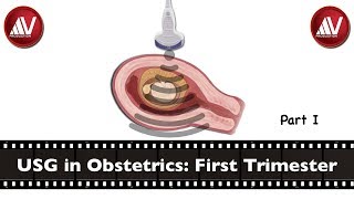 First Trimester Ultrasound Part I [upl. by Nho]