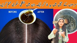 Get Rid Of Dandruff At Home Mix One Thing In Oil Treat Dandruff بال لمبے موٹے اور سلکی کرنے کا طریقہ [upl. by Asilim395]