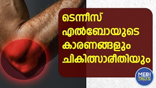 Reasons and Treatment for Tennis Elbow  Exercises to relieve Tennis Elbow  Malayalam  2024 [upl. by Llenwad432]